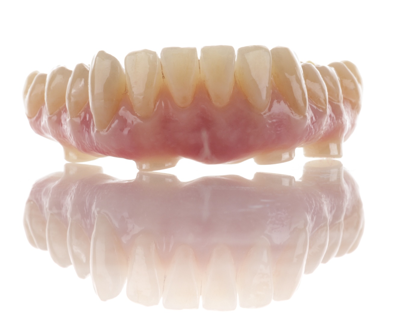 Fémmentes élethű cirkon híd több fog pótlására