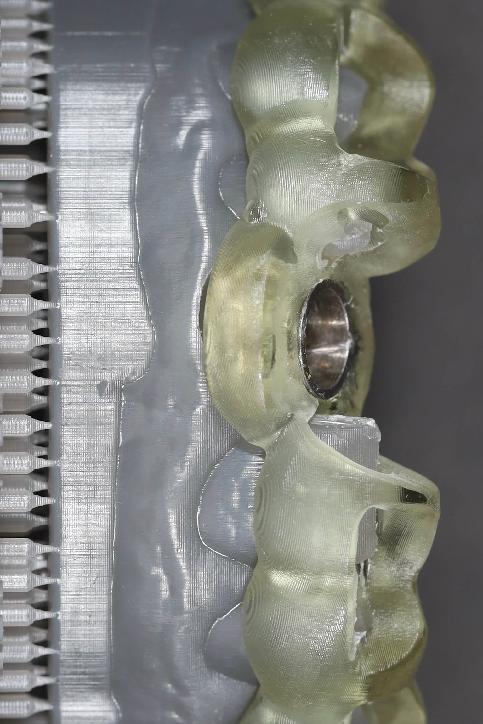 3D nyomtatott sebészi fúrósablon